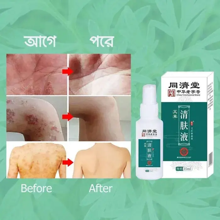 China Time-honored Brand Skin Solution (35ml) - Image 4