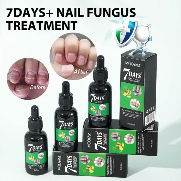 7 Days Nail Fungus Treatment Liquid