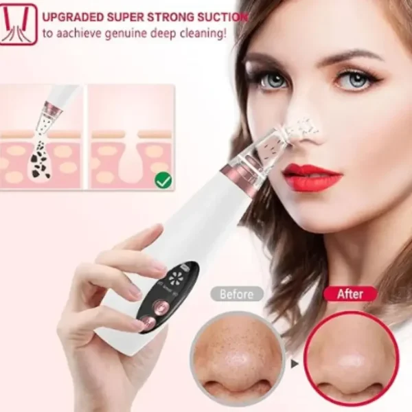Electric Blackhead Remover Vacuum