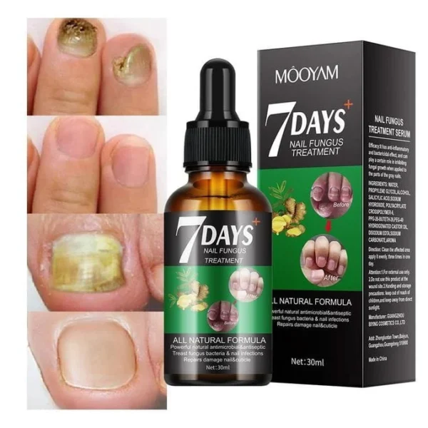 7 Days Nail Fungus Treatment Liquid