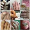 7 Days Nail Fungus Treatment Liquid