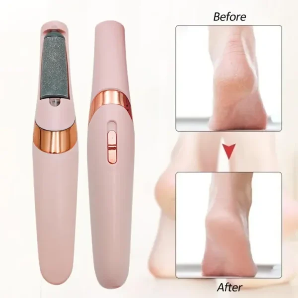 Electric Callus Remover & Feet Pedicure Machine Price