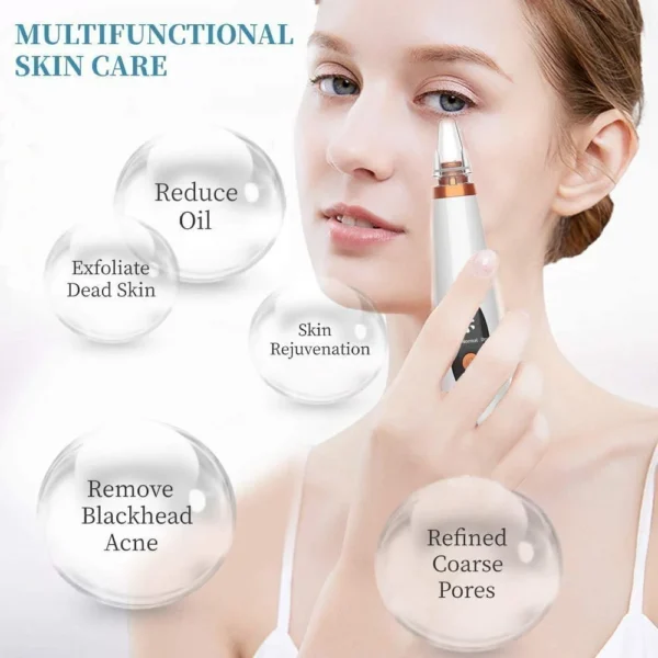 Electric Blackhead Remover Vacuum