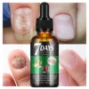 7 Days Nail Fungus Treatment Liquid