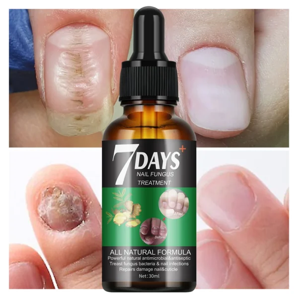 7 Days Nail Fungus Treatment Liquid