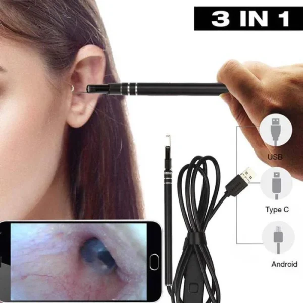 Smart Visual Ear Endoscope Camera