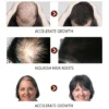444fd6f2-650c-4e73-a0fb-e2b6bfc879c0.webp EELHOE 7 Days Germinal Hair Growth Oil 20ml