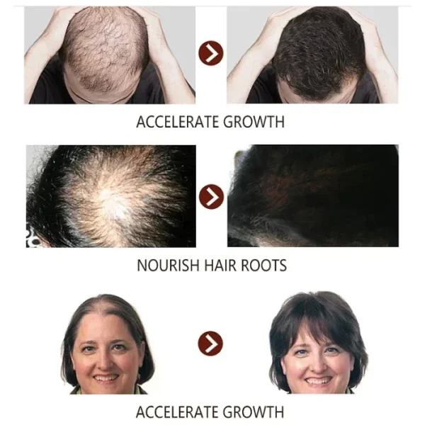 444fd6f2-650c-4e73-a0fb-e2b6bfc879c0.webp EELHOE 7 Days Germinal Hair Growth Oil 20ml