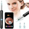 Smart Visual Ear Endoscope Camera