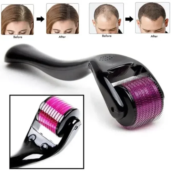 503c6033-e527-440b-82c1-a23dbfb80974.webp Derma Roller 0.5mm Titanium System