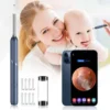 Smart Visual Ear Endoscope Camera