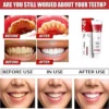 SP-4 Probiotic Toothpaste