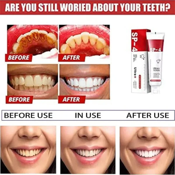 SP-4 Probiotic Toothpaste