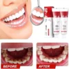 SP-4 Probiotic Toothpaste