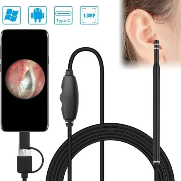 Smart Visual Ear Endoscope Camera