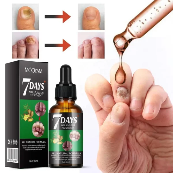 7 Days Nail Fungus Treatment Liquid
