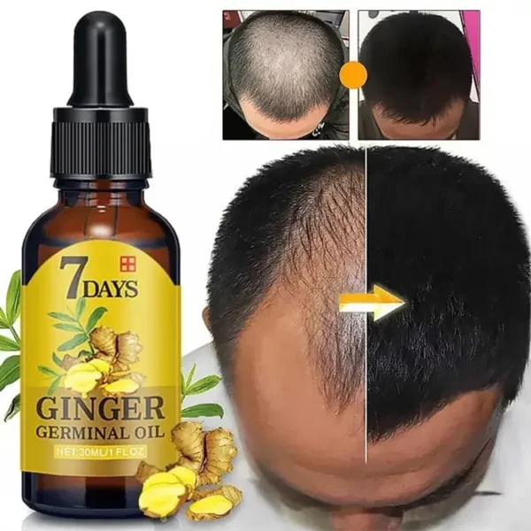 f162b668-be5b-4298-ade0-a9565a49caca.webp EELHOE 7 Days Germinal Hair Growth Oil 20ml
